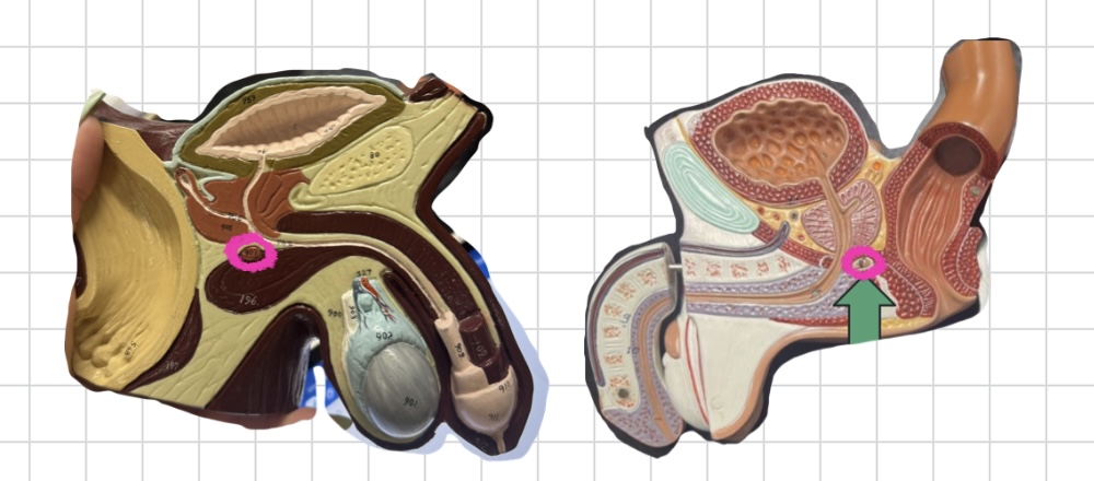 term image