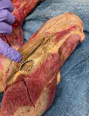 <p>Identify the muscle</p>