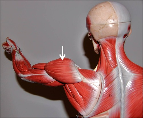 <p>What muscle is this?</p>