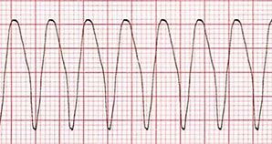 <p>sharp peaks, has a pattern</p>