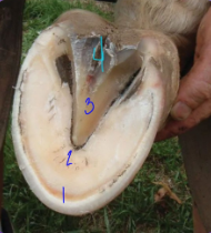 <p>If a nail pokes through the foot, which location causes the least amount of damage?</p>