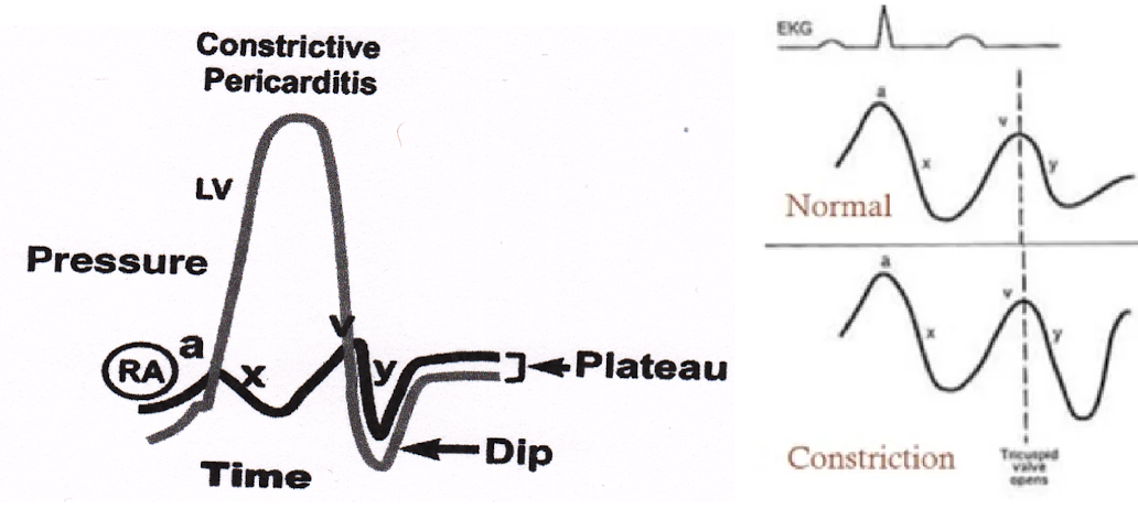 <p><strong>rapid āyā descent</strong> and <strong>ādip and plateauā</strong></p>