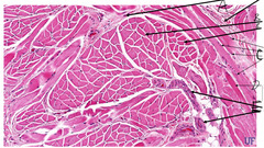 <p>What is indicated by the arrows labeled 'A' in this slide of tongue?</p>