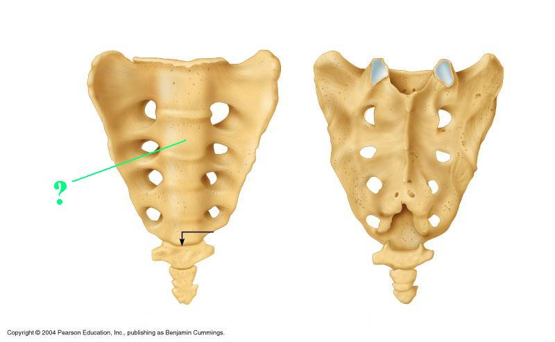 <p>Identify the indicated bone</p>