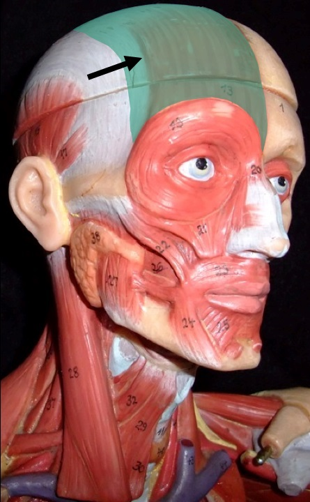 term image