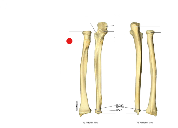 <p>Identify the structure pinned</p>