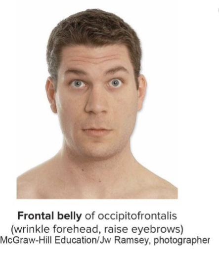<p>Frontal</p>
