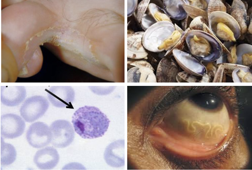 <ol><li><p><strong>Fungi</strong></p></li><li><p><strong>Algae</strong></p></li><li><p><strong>Protozoa</strong> (<strong>single</strong> <strong>celled</strong> organisms)</p></li><li><p><strong>Helminths</strong> (<strong>worms</strong>)</p></li></ol><p></p>
