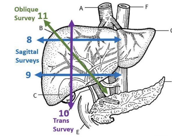 <p>Once you have surveyed the entire liver</p><ul><li><p>In longtudinal obtain an image of the left lobe of the liver parenchyma just to the left Hand side of the aorta (image 1)</p></li><li><p>In transverse obtain an image of the liver adjacent to the left main portal vein (image 2) the aorta and IVC should be displayed in the bottom left hand content of the image</p></li></ul><p></p>