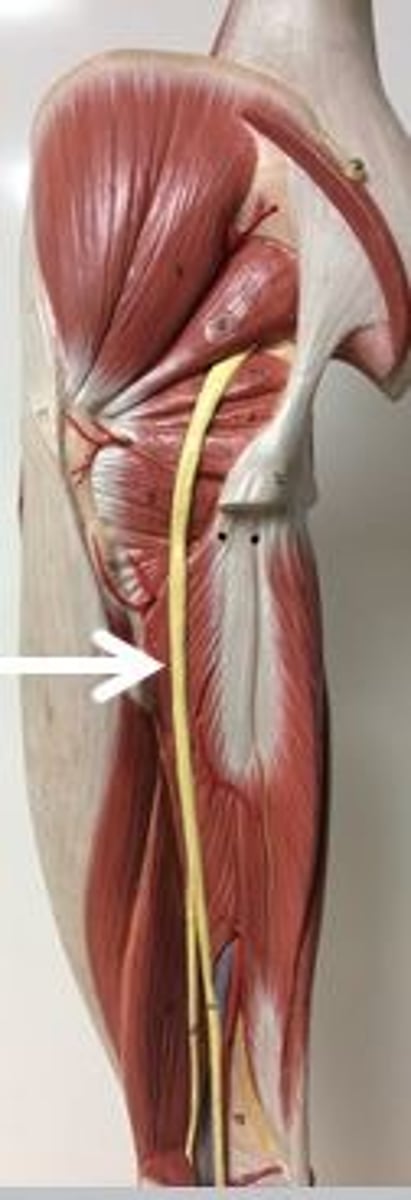 <p>Identify this nerve.</p>