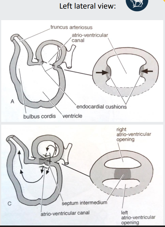 <p>At the atrioventricular region, two masses of cardiac mesenchymal tissue form (c<span style="color: purple;">ardiac cushions)</span></p><p></p><p>They extend towards each other and fuse</p><p></p><p>The fused cushions form the <strong>septum intermedium</strong></p><p></p><p>Separates the <span style="color: purple;">atrio-ventricular canal into right and left atrio-ventricular openin</span>gs</p>