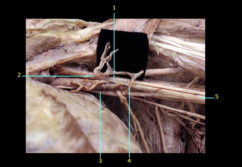 <p>Identify the nerve at 2</p>