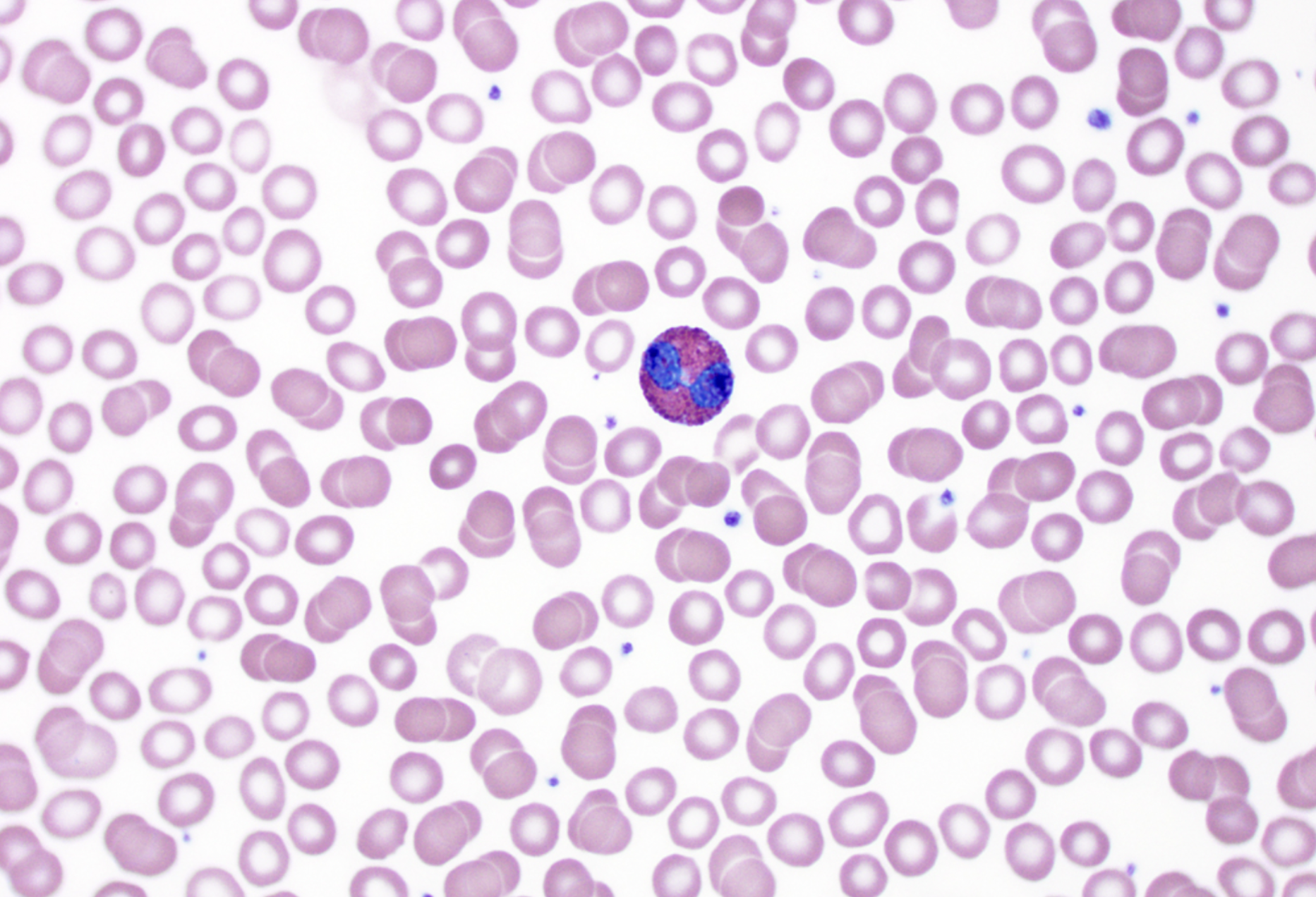 <p>Eosinophils</p><p>■ X-XX nucleus</p><p>■ XX</p><p>■ Fight XX</p><p>infections &amp; involved</p><p>with XX XX</p><p></p>