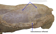 <p>What are the top arrows pointing to?</p>