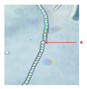 <p>This organism has thick walls because the process is what? Hint: does not use oxygen</p>