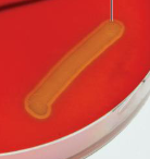 <p>What type of hemolysis is shown in the blood agar? </p>