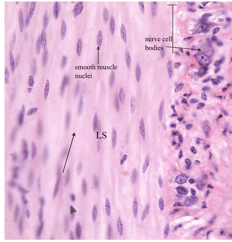 <p>Spindle shaped cells, banana shaped nuclei</p>