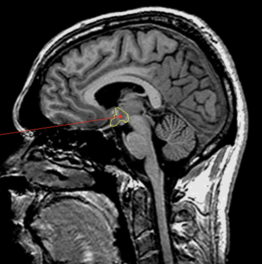 <p>What is the area highlighted called?</p>