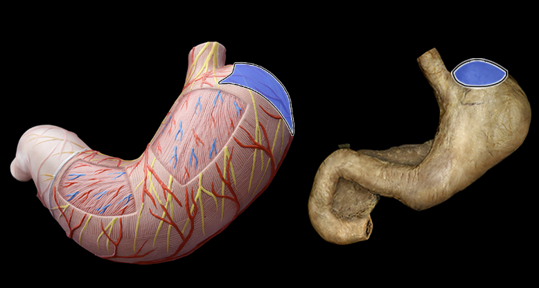 term image