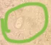 <p>Parasite or Artifact</p>