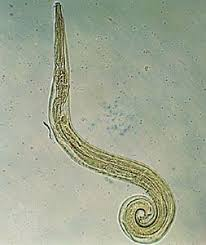 <p>Enterobius vermicularis</p>