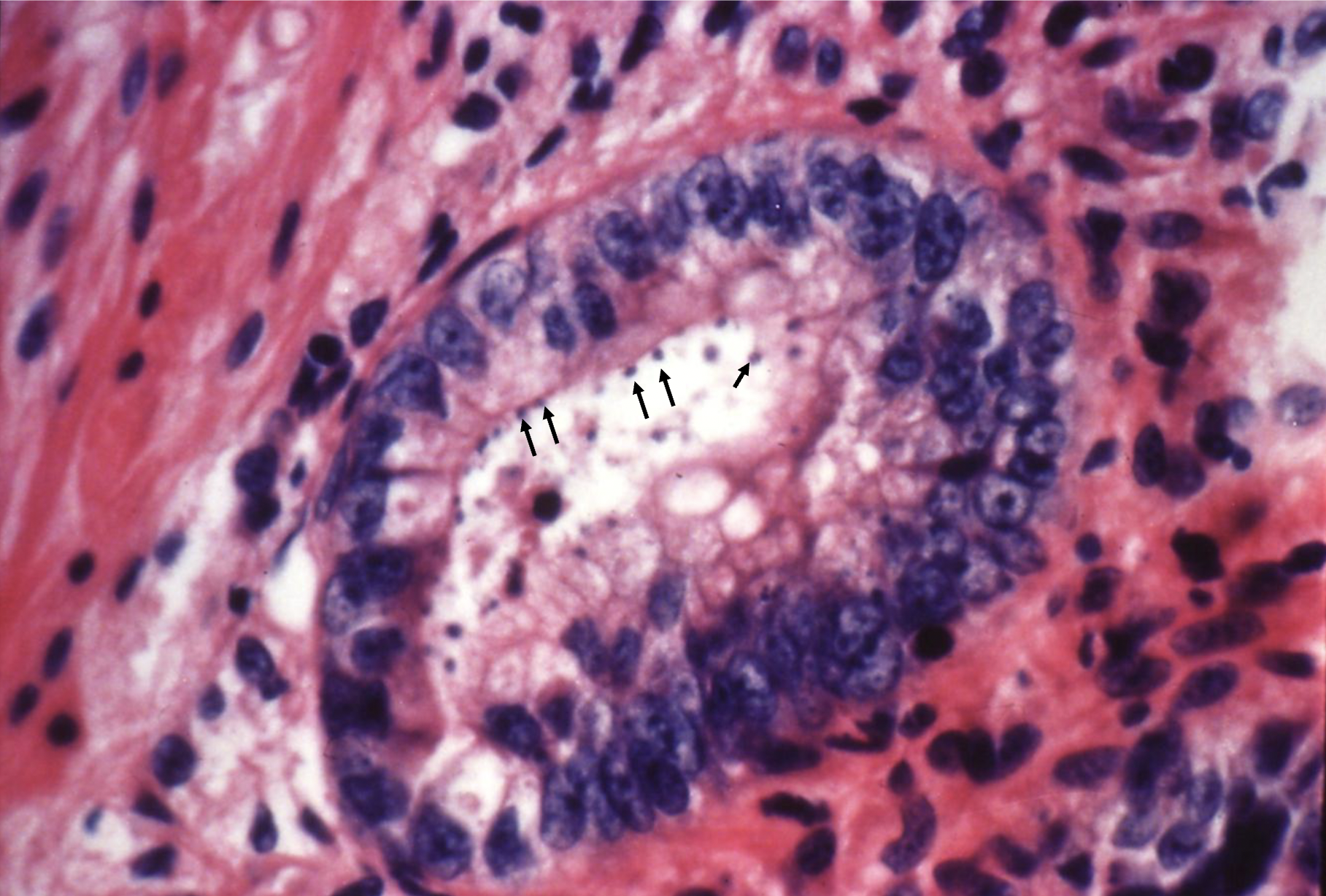<p>Intracellular, extracytoplasmic blue ‘beads’ in the brush border</p>
