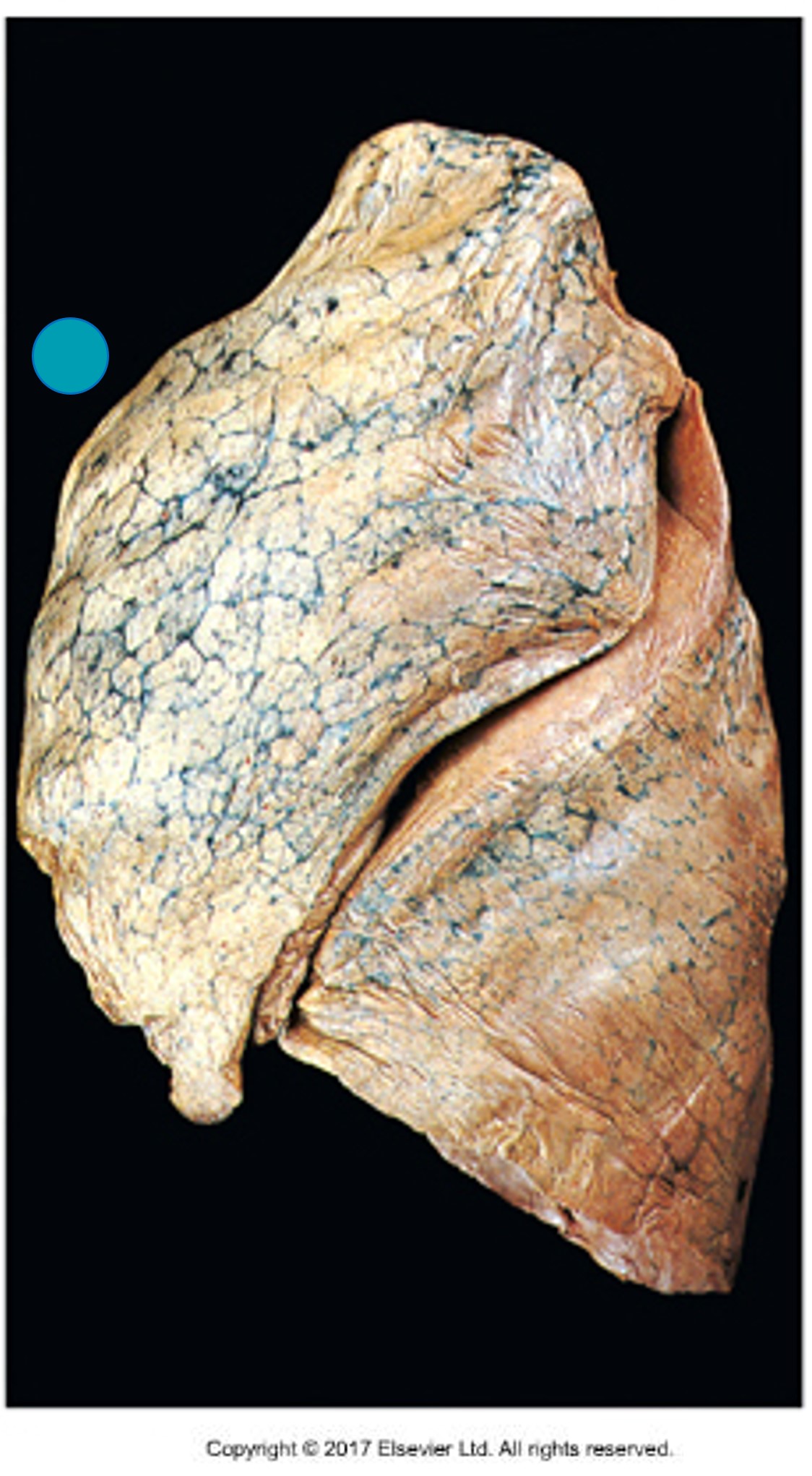 <p><span>The blue dot indicates the:</span></p>