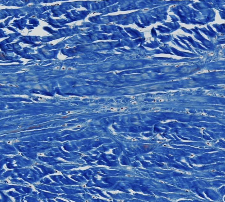 <p>Which type of CT is this?</p>
