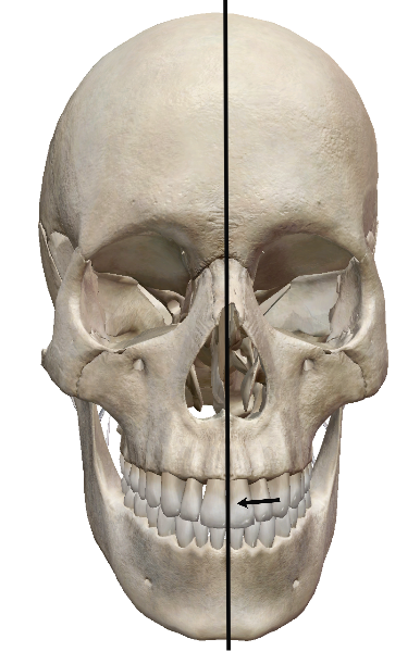 <p>Medial</p>