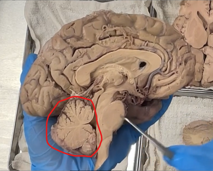 <p>This is a hemisection of the cerebellum. </p>