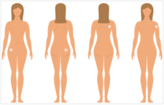 <p>Abdomen, buttock, back, or upper arm (minus Twirla)</p>
