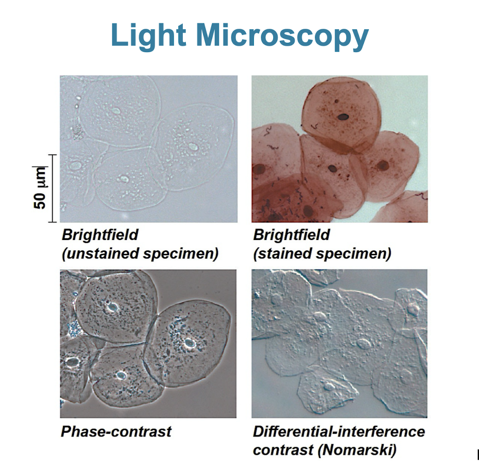 <p>visible light is passed through a specimen and then through glass lenses</p><ul><li><p>lenses refract/bend the light to magnify image</p></li><li><p>not able to see membrane organelles/sub-cellular structures (up to 200nm)</p></li></ul><p></p>