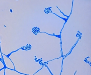 <p>Long, narrow branches of philiades with clusters of narrow (or thin) microconidia</p>