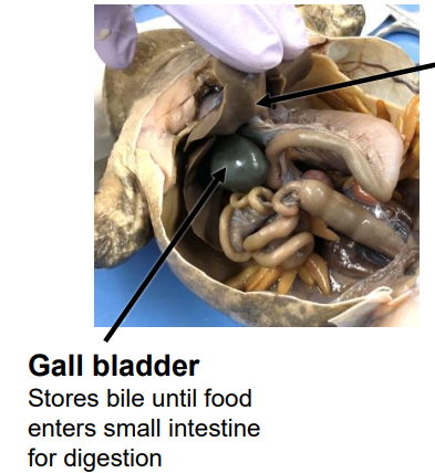 <p>stores bile until food enters small intestine for digestion</p>