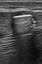 <p>Identify this image. </p>