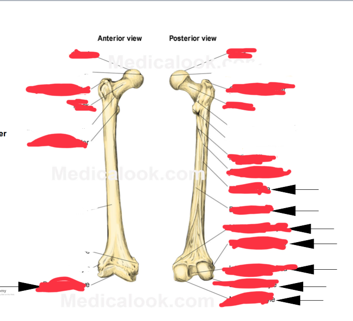 <p>Where is the head of the femur </p>
