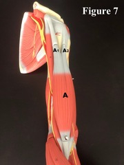 <p>A1</p>