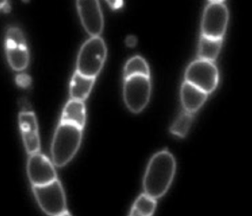 <p>what type of mutant is this?</p>