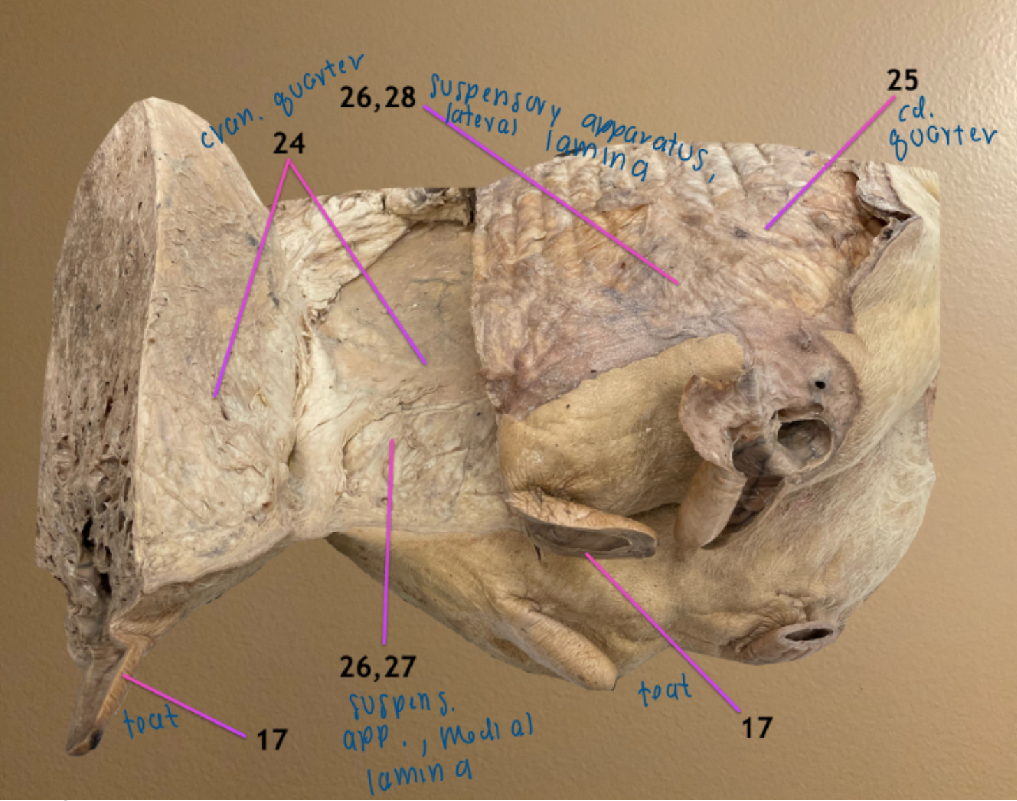 <ol start="26"><li><p>suspensory apparatus</p></li><li><p>medial lamina of the suspensory apparatus: meets at midline</p></li><li><p>lateral lamina of the suspensory apparatus: covers lateral surf of mamm gland, deep to skin</p></li></ol><p></p>