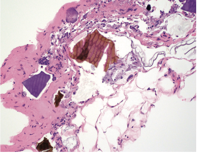 <p>1) Diagnostic</p><p>2) risque</p>