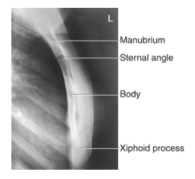 <ul><li><p>Entire sternum with minimal overlap of soft tissues</p></li></ul><p></p>