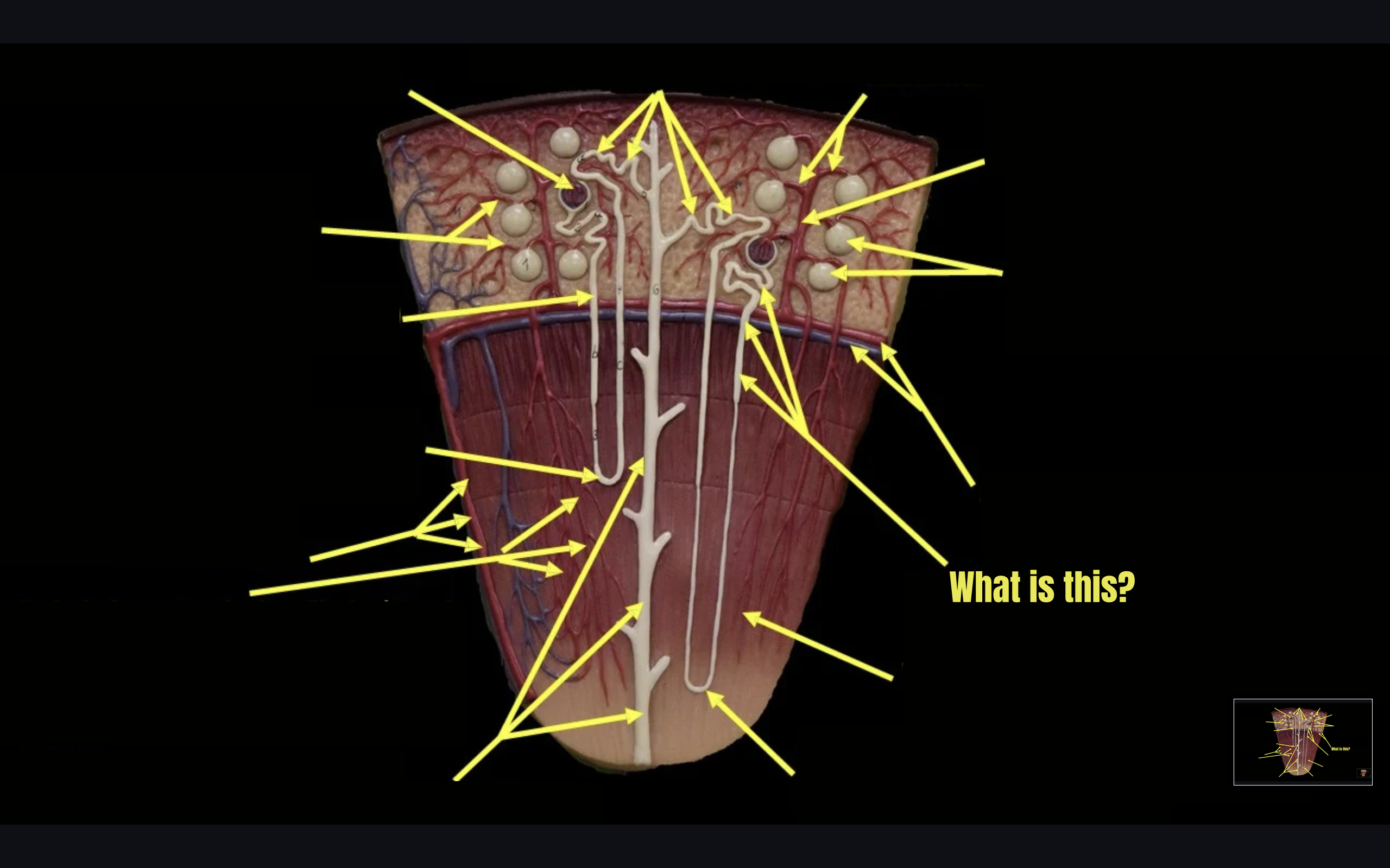 term image