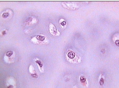 <p>Translates to lakes </p><p>Cavities/pits </p><p>Houses chondrocytes </p>