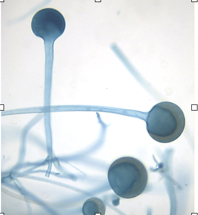<p>Is this a photo of sporangia or zygosporangia?</p>