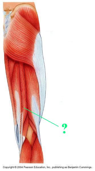 <p>Identify the indicated muscle</p>