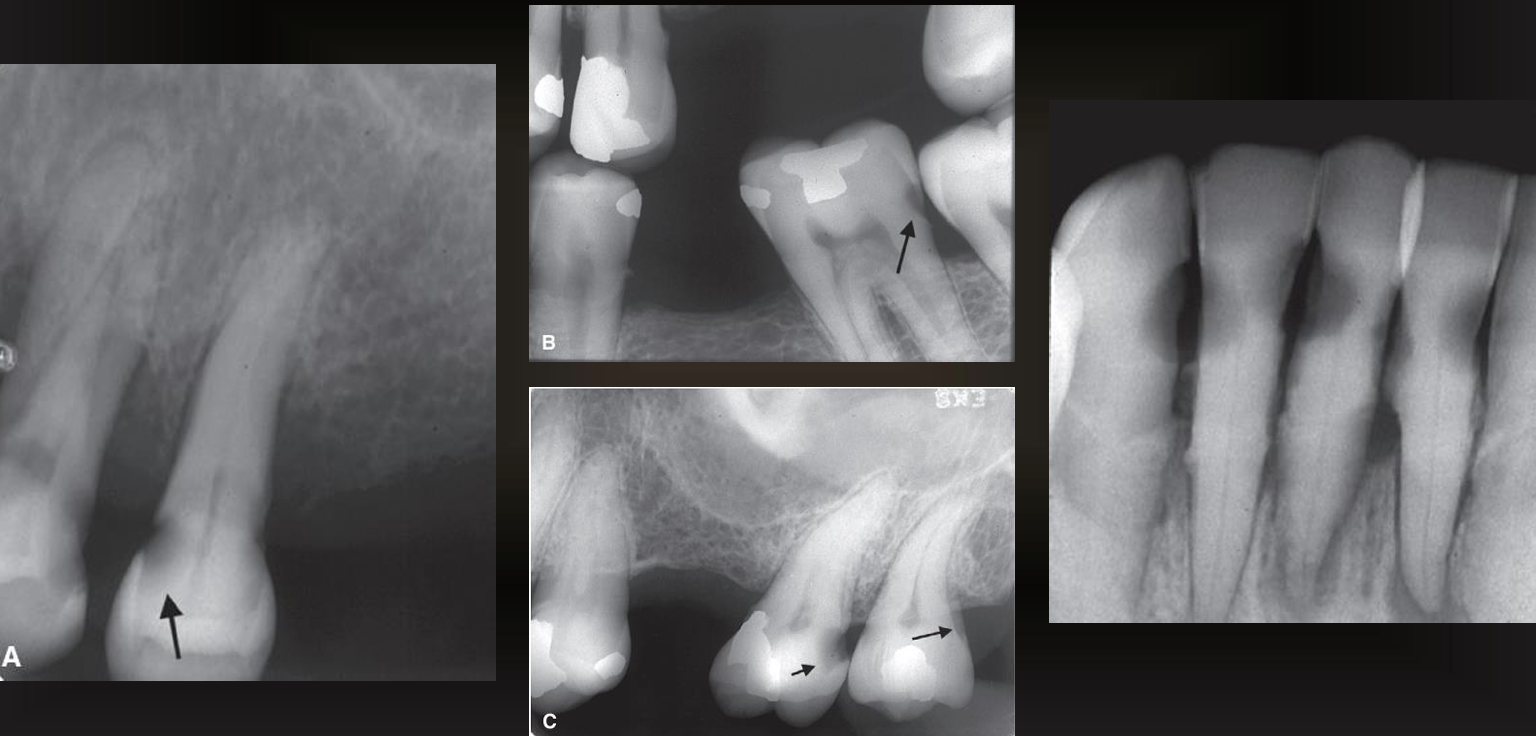 <p>what are the arrows pointing to?</p>