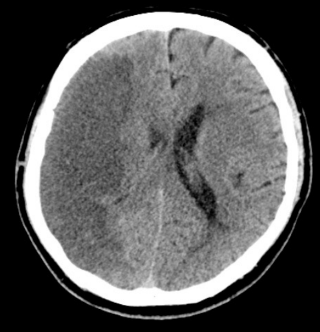 <p>Name the pathology </p>