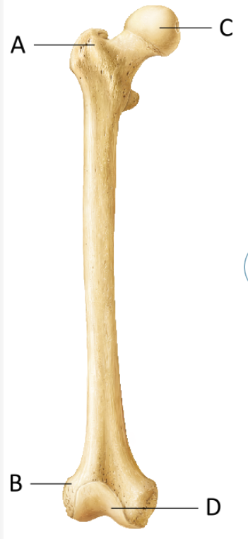 <p>What is the bone feature at A?</p>