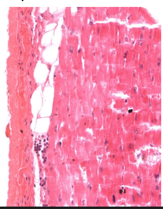 <p>Identify this structure </p>