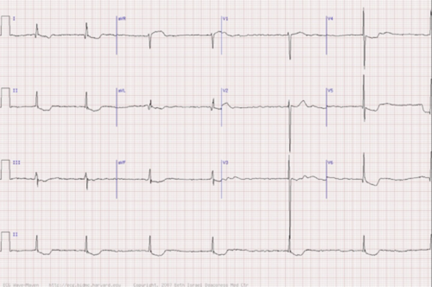 <p>howd yk this is dig tox</p>